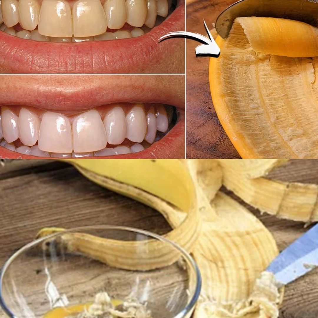 A Brighter Smile with a Simple Secret: The Banana Peel Trick