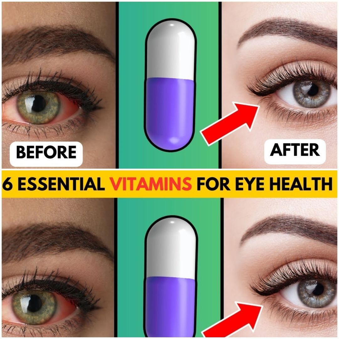 Enhancing Eye Health and Aesthetic Appeal with Essential Vitamins