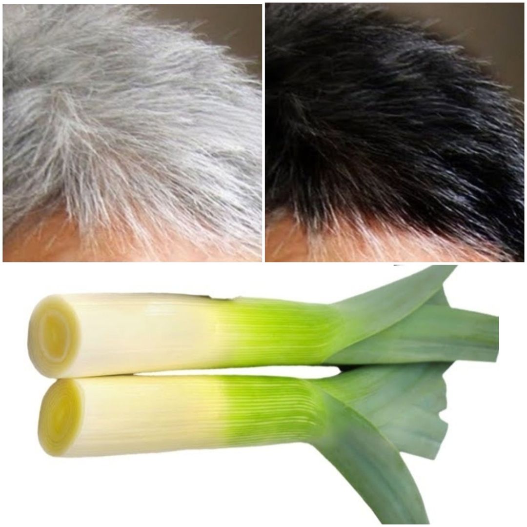 Say Goodbye to Gray Hair with These Simple Home Remedies!