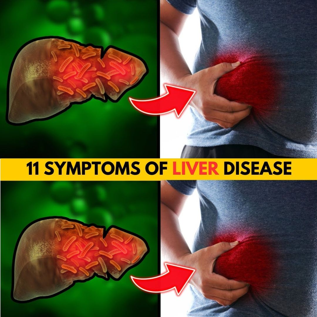 Understanding the Importance of Liver Health: 12 Common Signs to Watch Out For