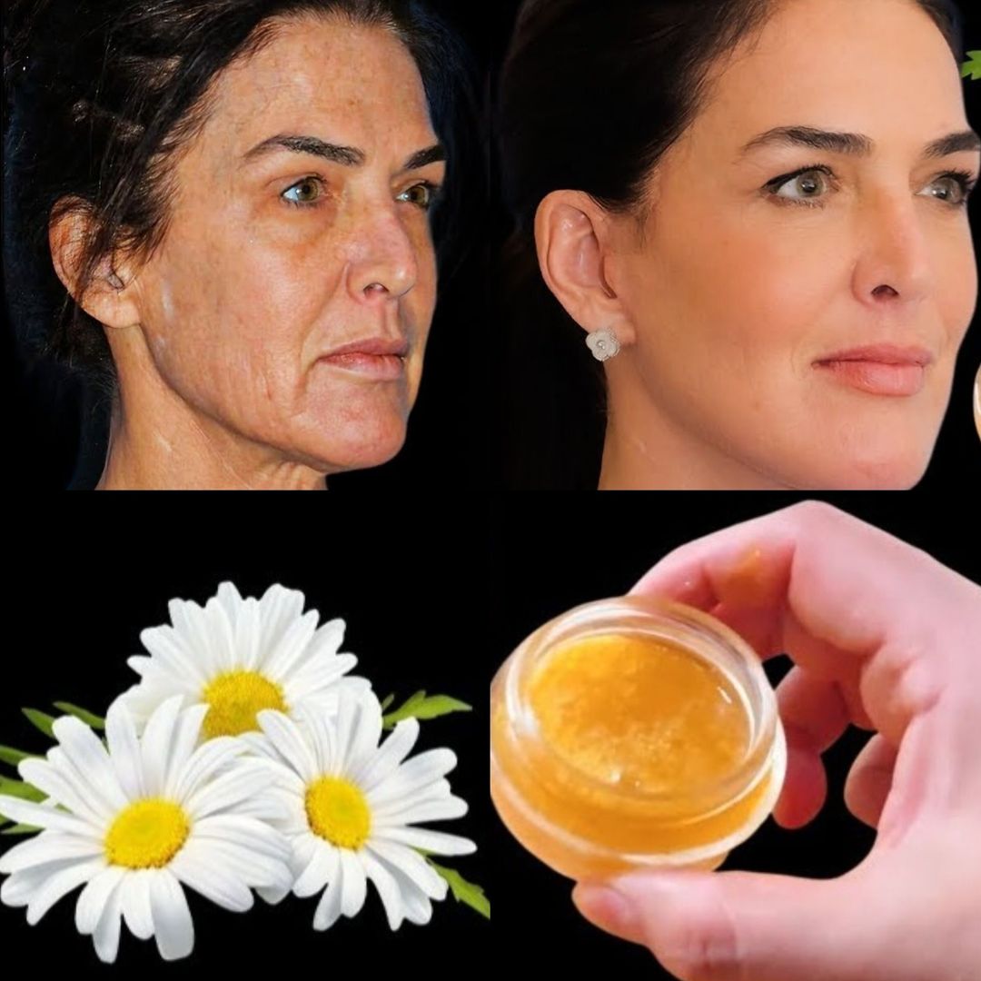 Achieve Youthful Skin with Homemade Chamomile Anti-Aging Cream