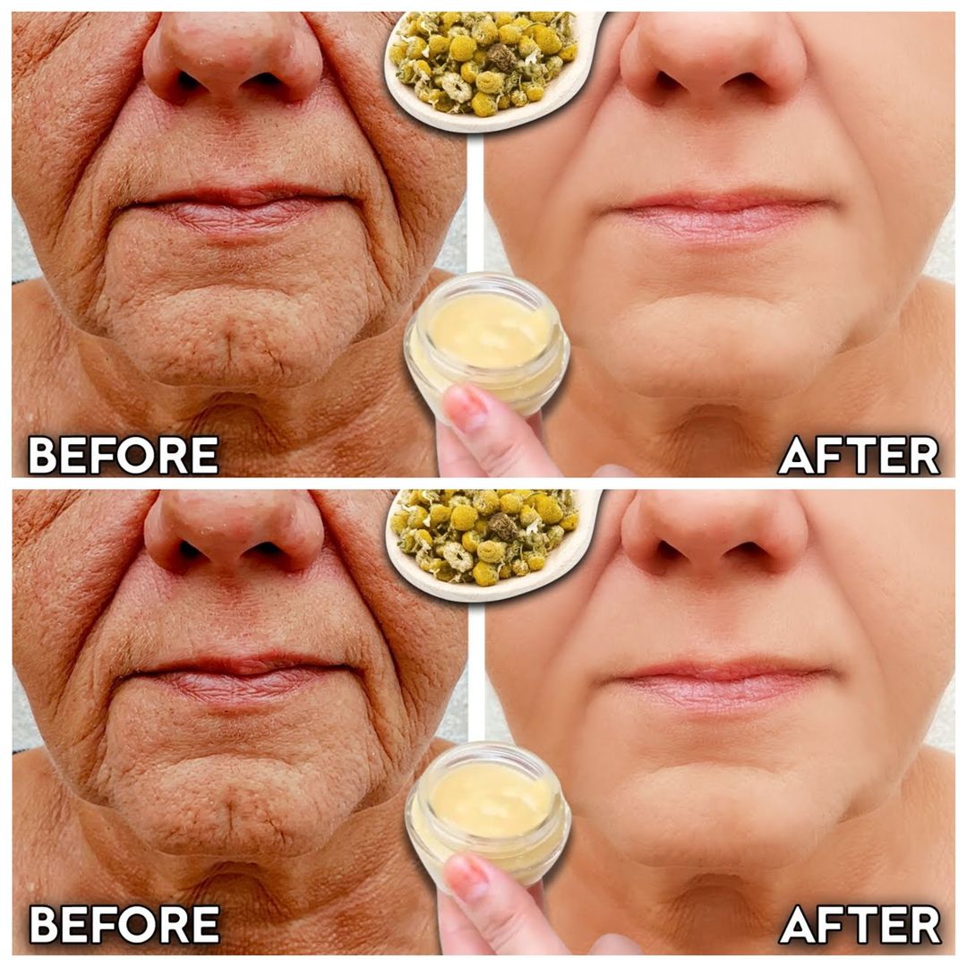 Say Goodbye to Wrinkles: Try This Natural Chamomile Cream for Youthful Skin!