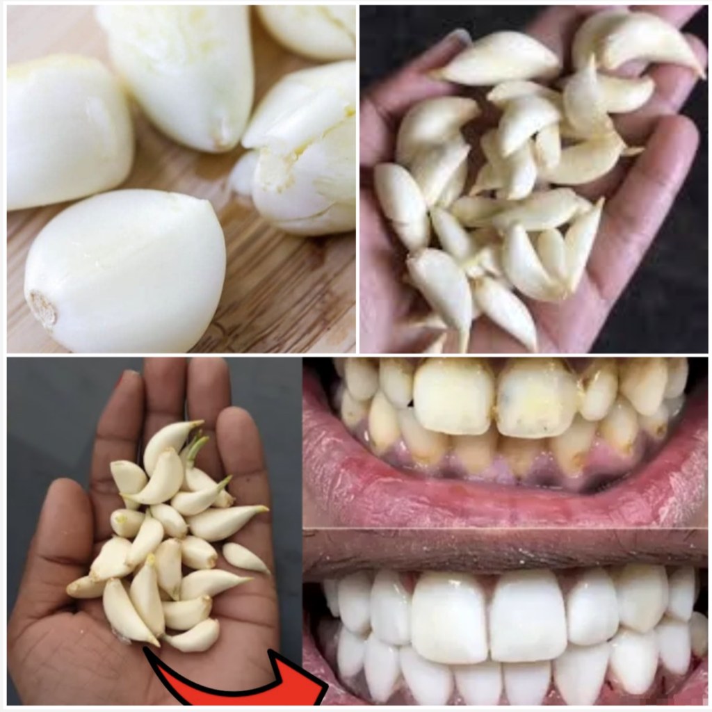 Unlock the Secret to a Brighter Smile with Garlic