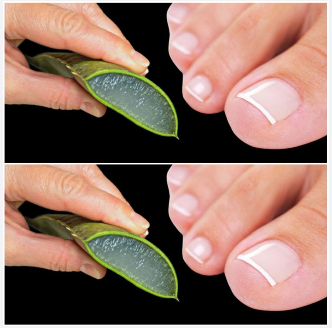 Discover the Healing Power of Aloe for Healthy Nails