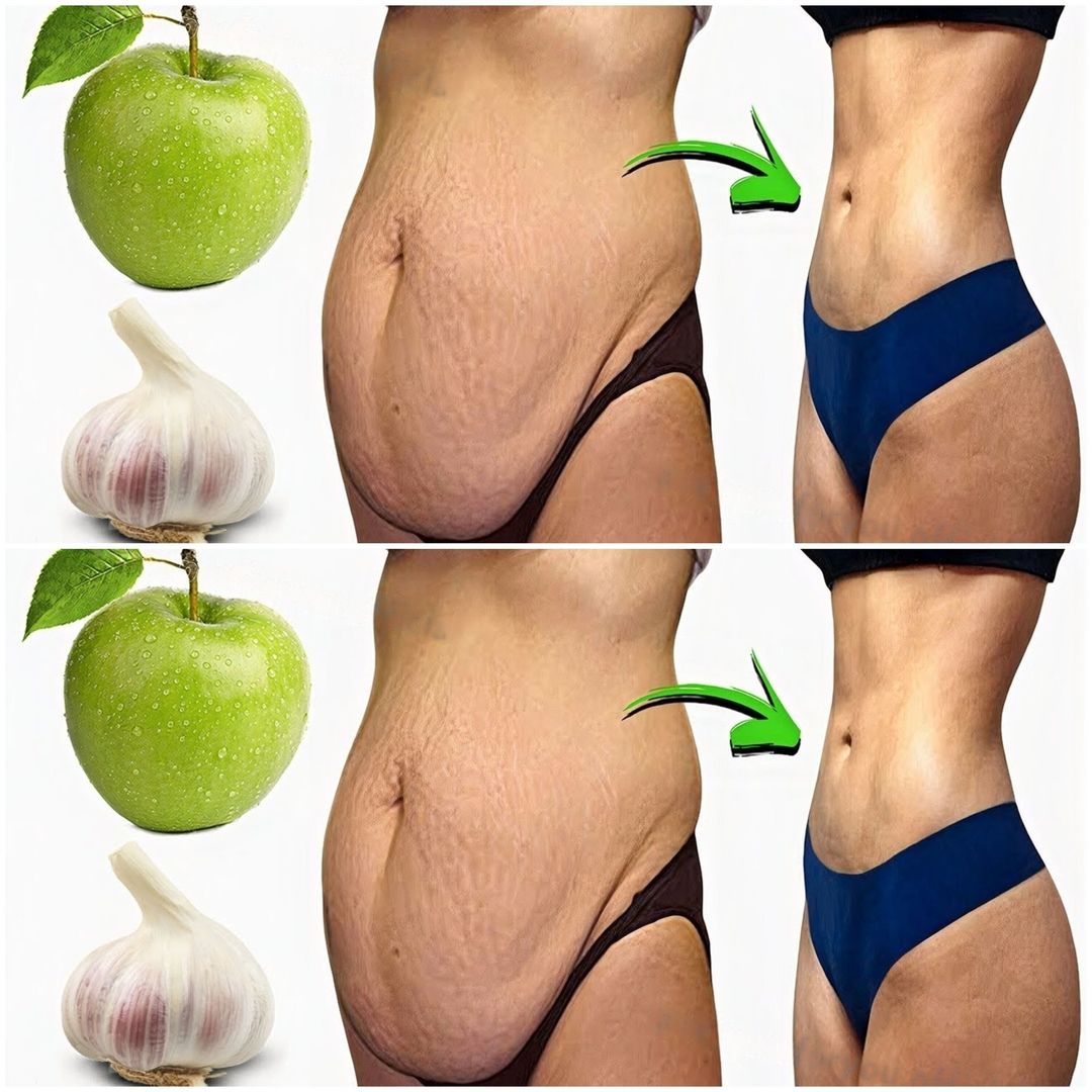 Discover the Secret of Garlic-Infused Apple Drink for Weight Loss!