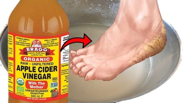 Rejuvenate Your Feet with Vinegar Soaks